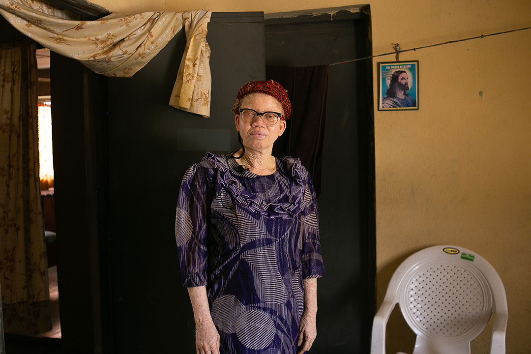Victoria, a Nigerian woman with albinism, stands for a portrait.