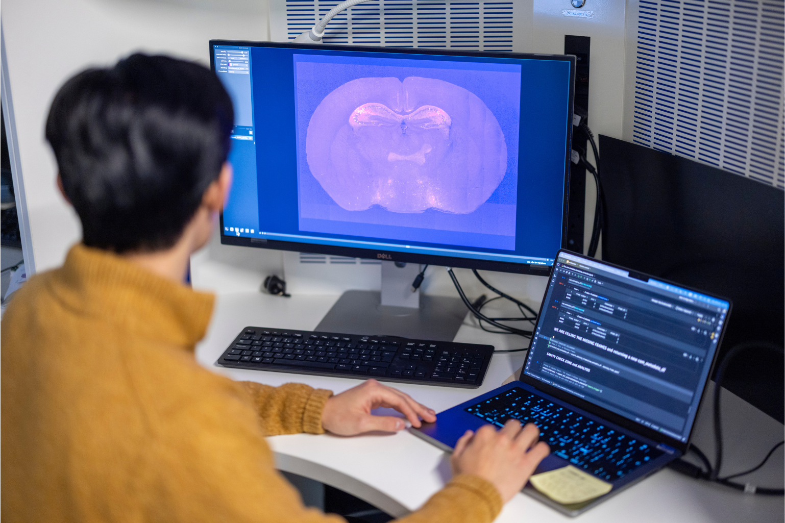 A PhD student with black hair, wearing a yellow jumper, examines a brain scan on a screen in the neuroimaging lab at the Sainsbury Wellcome Centre.