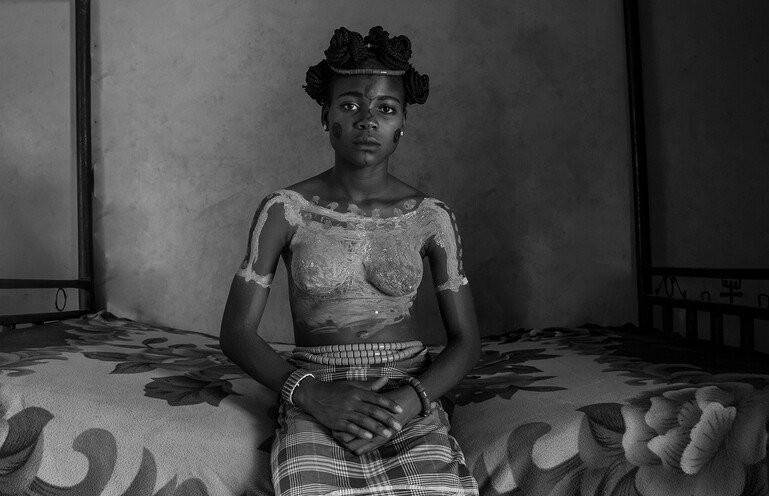 A teenage girl sits in her healing room, having recently been circumcised