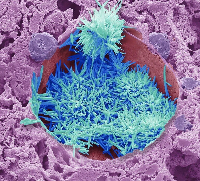 Cholesterol in the Liver