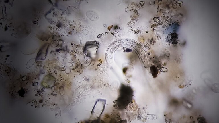 Microscope view of a translucent organism among fragments of organic material.