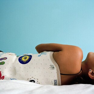 A girl who has scoliosis is laying down and wearing a brace that she has decorated to make it her own