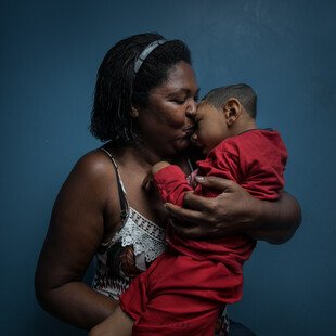 Small boy with microcephaly being cuddled by the woman who adopted him