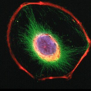 A 3T3 fibroblast cell before it divides in culture