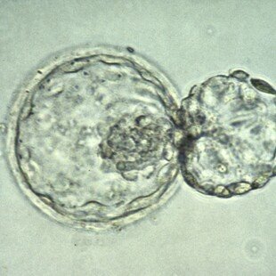 Human blastocyst hatching