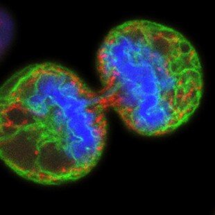Human melanoma cell dividing
