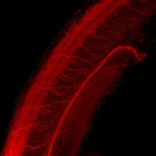 Neural tube of zebrafish embryo