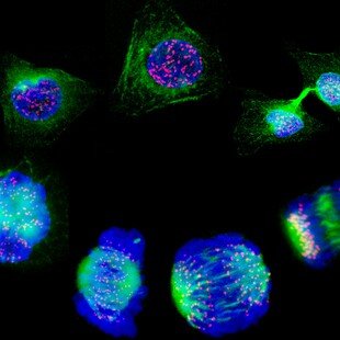 Human cells showing the stages of cell division