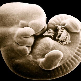 SEM of mouse foetus