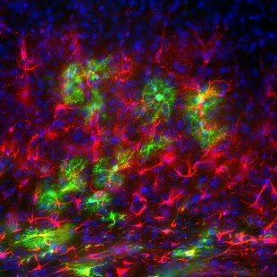 Neural stem cells transplanted into mouse brain