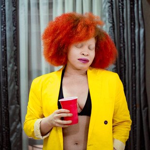 A Nigerian woman with albinism poses for a portrait.