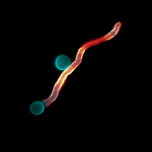 Microscopic image of hypha growing from a germinated spore.