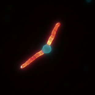 Microscopic image of a germinated spore.