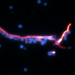 Microscopic image of hyphae and spores.