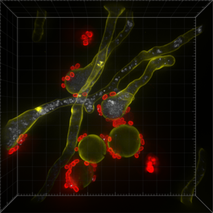 Microscopic image of fungal hyphae and spores.