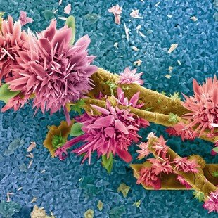 One of the winning images for the 2014 Wellcome Image Awards. Scanning electron micrograph of waste from an industrial farming process by Eberhardt Josué Friedrich Kernahan and Enrique Rodríguez Cañas.