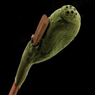 One of the winning images for the 2014 Wellcome Image Awards. Scanning electron micrograph of a nit or head louse egg attached to a strand of human hair by Kevin Mackenzie.