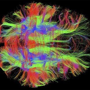 One of the winning images for the 2014 Wellcome Image Awards. Diffusion-weighted magnetic resonance imaging scan of nerve fibres in a normal, healthy adult human brain by Zeynep M Saygin.
