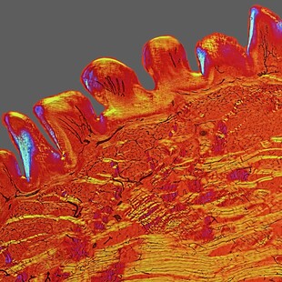 One of the winning images for the 2015 Wellcome Image Awards. Polarised light micrograph of a cross-section through part of a cat’s tongue by David Linstead.