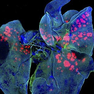 One of the winning images for the 2015 Wellcome Image Awards. Confocal micrograph of medicine being delivered into the lungs of a mouse by Gregory Szeto, Adelaide Tovar and Jeffrey Wyckoff, Koch Institute, MIT.
