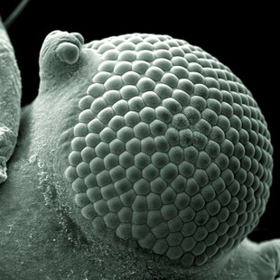 One of the winning images for the 2015 Wellcome Image Awards. Scanning electron micrograph of a greenfly eye by Kevin Mackenzie, University of Aberdeen.