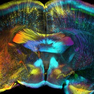 One of the winning images for the 2015 Wellcome Image Awards. Confocal micrograph of nerve cells inside a section of adult mouse brain by Luis de la Torre-Ubieta, Geschwind Laboratory, UCLA.