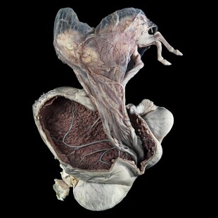 Overall winner for the 2015 Wellcome Image Awards. A photograph of a pregnant pony uterus by Michael Frank, Royal Veterinary College.