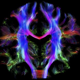 One of the winning images for the 2016 Wellcome Image Awards. Tractography showing pathways of nerve fibres in the brain of a young healthy adult by Alfred Anwander, Max Planck Institute for Human Cognitive and Brain Sciences.