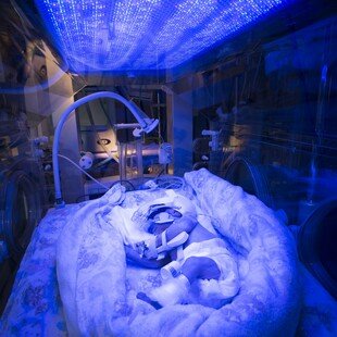 Julie Dorrington winner for the 2016 Wellcome Image Awards. A photograph of a newborn baby receiving light therapy by David Bishop, Royal Free Hospital, London.