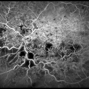 One of the winning images for the 2016 Wellcome Image Awards. A fluorescein angiograph of the blood vessels inside a person’s eye by Kim Baxter, Cambridge University Hospitals NHS Foundation Trust.