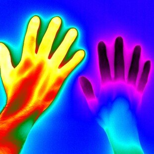 One of the winning images for the 2016 Wellcome Image Awards. Thermal imaging of a healthy hand and the hand of a person with Raynaud’s disease by Matthew Clavey, Thermal Vision Research.