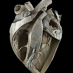 One of the winning images for the 2016 Wellcome Image Awards. A photograph of the heart from an adult cow by Michael Frank, Royal Veterinary College.