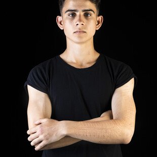 Portrait of an 18-year-old man with a history of self-harming.