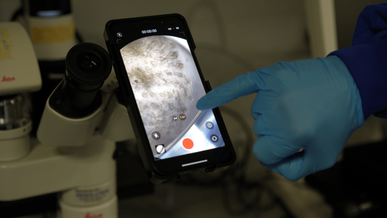 A smartphone is shown recording specimen from a microscope. A hand is pointing at the screen.