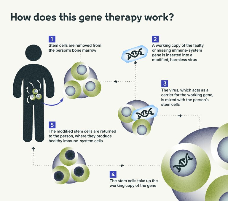 Diagram showing how stem cells are modified with a working gene and returned to the body to rebuild immunity.