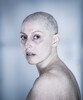 Portrait of a woman with breast cancer, who has lost her hair due to chemotherapy.